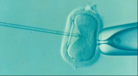 Fecundación in vitro